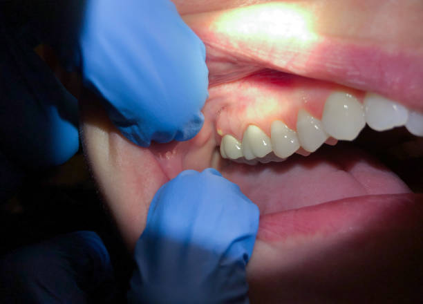 Best Emergency Orthodontic Repairs in Cordova, AK